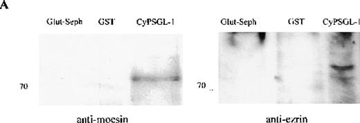 Fig. 5. Western blot analysis of proteins interacting with the cytoplasmic tail of PSGL-1 in HL-60 cells. / HL-60 cell lysates were incubated with equivalent amounts of glutathione-Sepharose, glutathione S-transferase (GST), and GST-CyPSGL-1 fusion protein bound to glutathione-Sepharose 4B beads. Each immunoprecipitate was immunoblotted after 8% sodium dodecyl sulfate-polyacrylamide gel electrophoresis (SDS-PAGE) with antimoesin 95/2 polyclonal antibody (pAb), antiezrin 90/3 pAb (A), or antivinculin mAb (B). Cell lysate blotted with antivinculin was included as the positive control.