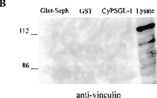Fig. 5. Western blot analysis of proteins interacting with the cytoplasmic tail of PSGL-1 in HL-60 cells. / HL-60 cell lysates were incubated with equivalent amounts of glutathione-Sepharose, glutathione S-transferase (GST), and GST-CyPSGL-1 fusion protein bound to glutathione-Sepharose 4B beads. Each immunoprecipitate was immunoblotted after 8% sodium dodecyl sulfate-polyacrylamide gel electrophoresis (SDS-PAGE) with antimoesin 95/2 polyclonal antibody (pAb), antiezrin 90/3 pAb (A), or antivinculin mAb (B). Cell lysate blotted with antivinculin was included as the positive control.