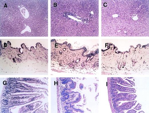 Fig. 2. Histopathologic examination of liver, skin, and intestine tissues from mice with acute GVHD treated with anti-CD134L mAb. / Induction of lethal acute GVHD (B, E, and H) and administration of anti-CD134L mAb (C, F, and I) were performed and acute-GVHD–negative controls (A, D, and G) were generated as described in the legend for Figure 1. On day 28 after BMT, 3 mice in each group were killed. Paraffin sections of the liver (A-C), skin (C-F), and intestine (G-I) were stained with hematoxylin and eosin. The specimens shown are from 3 representative mice in each group with similar histologic features. Original magnification, ×200.