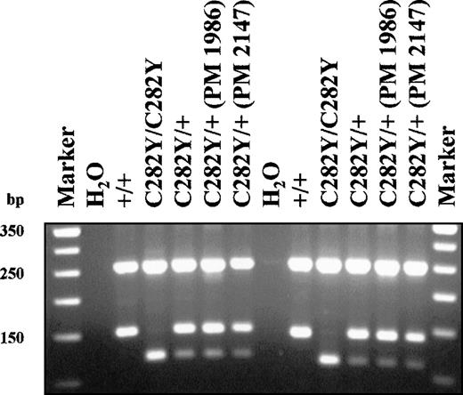HFE C282Y mutation detection assay. / Lanes 1 and 14 contain 50 bp marker as indicated at the left of the figure. Lanes 2-7 contain samples as indicated above the gel. All reactions were performed with the original Feder et al (1996) primers. Lanes 8-13 contain the samples indicated above the gel. All reactions were performed with the original Feder et al2 forward primer and the Jeffrey et al4 reverse primer. Known polymorphic samples are indicated (PM 1986, PM 2147) and were prepared in the Molecular Diagnostic Lab of the University of Alberta as described in Somerville et al.5 All other DNA samples were obtained from either blood or buccal cells and were prepared in the MSU DNA Diagnostic Laboratory by a standard alkaline lysis procedure. Each PCR reaction contains 12.5 pmoles each primer, 1× Rediload (Research Genetics), 10 mmol/L dNTPs, 1× GeneAmp PCR buffer (Perkin-Elmer: 50 mM KCl, 10 mM Tris-HCl (pH 8.3), 1.5 mM MgCl2, 0.01% w/v gelatin), and 0.25 U Taq DNA polymerase in a total reaction volume of 25 μL. Conditions for amplification: 95°C, 5′; 30 cycles of 94°C, 30"; 63°C, 30"; 72°C 30"; hold at 4°C. All PCR reactions were performed in a Perkin-Elmer 9600 thermocycler. PCR products (390 bp) are digested with RsaI to give 250 bp + 140 bp for a normal result, or 250 bp + 140 bp + 111 bp + 29 bp for a C282Y carrier, or 250 bp + 111 bp + 29 bp for a mutant C282Y homozygote. Restriction digestion products are run on a 3% Nu-Sieve 3:1 (FMC BioProducts) agarose gel in 0.5× TBE.