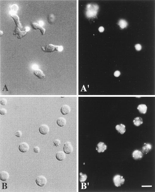 Fig. 1. Combined DIC and fluorescence image (A), DIC image (B), and fluorescence images (A′, B′) of living neutrophils. / Cells were labeled at 4°C with anti-CD43 mAbs (A, A′) or anti-CD11b mAbs (B, B′) and TRITC-conjugated F(ab′)2 fragments of secondary antibodies. They were analyzed at 37°C as described in “Materials and methods”. (A, A′) Polarized, locomoting neutrophils with CD43 caps located at the uropods. (B, B′) Round, stationary neutrophils with uniformly patched CD11b. Scale bar = 10 μm. (Panel A, the top left corner cell is round, nonpolarized, and nonmotile.)