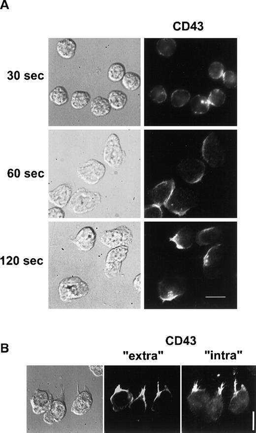Fig. 3. CD43 distribution in neutrophils developing locomotory activity on fibronectin. / (A) Neutrophils were allowed to settle on fibronectin for 5 minutes at 37°C and were stimulated by fMLP for 30, 60, and 120 seconds. Cells were then fixed and labeled for CD43. (B) After 5 minutes of locomotion on fibronectin, at 37°C, cells were fixed and double labeled for CD43 extracellular domain (Alexa 488) and for CD43 intracellular domain (rhodamine). Scale bars = 10 μm.