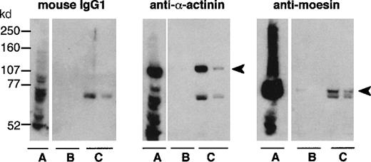 Fig. 6. Analysis of actin-binding proteins binding to rCD43intra-Sepharose. / Whole cytosol (A) and the 2 first fractions eluted with purified rCD43intra from BSA-Sepharose (B) or from rCD43intra-Sepharose (C) were submitted to 7.5% acrylamide-PAGE electrophoresis and analyzed by Western blotting with control mouse IgG1, anti–α-actinin or antimoesin.