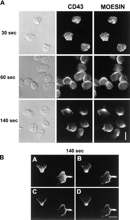 Fig. 7. CD43 (Alexa 488) and moesin (TRITC) double labeling of migrating neutrophils. / Cells, stimulated by fMLP, were allowed to locomote on fibronectin as described in “Materials and methods”. Cells were then fixed and permeabilized after 30, 60, or 140 seconds of locomotion. After washes and saturation steps, cells were double labeled for CD43 and moesin. A represents DIC and fluorescent images as indicated. B represents confocal images of CD43 (A, C) and of moesin (B, D). A and B represent a summation of the 19 planes of the stack; C and D represent a single plane from the middle of the stack. Scale bars = 10 μm.