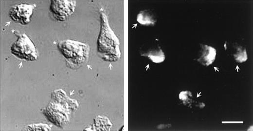 Fig. 8. DIC and fluorescent images of neutrophils labeled for -actinin. / Cells, stimulated by fMLP, were allowed to locomote on fibronectin for 2 minutes. Cells were then fixed and permeabilized and labeled for α-actinin. Arrows indicate the position of the lamellipodium; asterisk indicates the uropod position. Scale bar = 10μm.