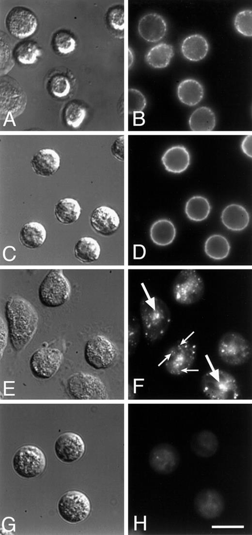 Fig. 7. C6-NBD-gal on the surface of PMNs is endocytosed and trafficked through an endocytic recycling compartment (ERC) before being transported back out to the cell surface. / PMNs were labeled with the fluorescent lipid analogue C6-NBD-gal (C-F) or with a Cy3-conjugated, nonfunction-blocking monoclonal antibody to α5 (Cy3-VC5; A, B), then maintained at 4°C (A-D) or warmed to 37°C for 30 minutes (E-H). After this warm-up, cells were incubated for an additional 2 minutes (E, F) or 30 minutes (G, H) in back exchange medium. Cy3-VC5 and C6-NBD-gal are initially found on the plasma membrane (A-D). After a 30-minute incubation at 37°C, both Cy3-VC5 and C6-NBD-gal accumulate in a central compartment (see Figure8). Two minutes after back exchange of C6-NBD-gal from the plasma membrane, a central compartment is clearly visible in the cells (large arrows, panel F) and in some cases C6-NBD-gal–labeled vesicles (small arrows, panel F) appear to be emanating from the central compartment. By 30 minutes after warm-up, almost all of the C6-NBD-gal has been returned to the plasma membrane and been back exchanged into the medium (H). DIC images are shown in (A, C, E, and G). Bar = 10 μm.