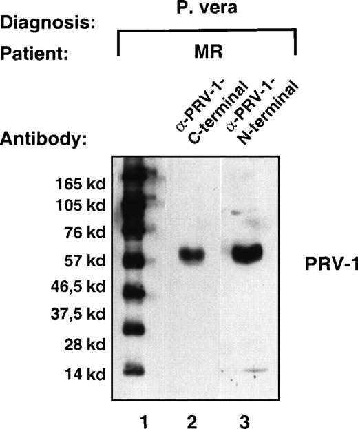 Fig. 4. Expression of the PRV-1 protein in granulocytes from a patient with PV. / Granulocytes were isolated from peripheral blood to more than 98% purity. Total cell extracts were prepared and subjected to SDS-PAGE. The proteins were blotted onto a nylon membrane and decorated with either the antibody raised against the C-terminal peptide (amino acids 368-383, lane 2) or the antibody raised against the N-terminal peptide (amino acids 13-25, lane 3). Immune complexes were detected by decoration with peroxidase-conjugated secondary antibody and visualized by chemoluminescence. Lane 1 shows a molecular size marker. The film was exposed for 5 seconds.