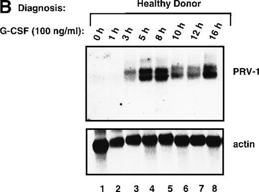 Fig. 8. Expression of PRV-1 in granulocytes from healthy volunteers treated with G-CSF in vivo and in vitro. / Granulocytes were isolated from peripheral blood of untreated and G-CSF-treated healthy volunteers and a patient with PV. Total RNA was extracted and a Northern blot prepared using 10 μg RNA. (A) Lane 1 patient with PV, lane 2 empty, lanes 3 and 4 healthy volunteers treated with G-CSF in vivo, and lanes 5 and 6 untreated healthy volunteer donors. (B) Lane 1 unstimulated granulocytes; lanes 2-8, granulocytes stimulated in vitro for the indicated times with 100 ng/mL G-CSF. (Top) The membrane was probed with a 1.1-kb fragment of the PRV-1 cDNA. (Bottom) The membrane was stripped and reprobed with a 1.2 kb fragment of the human β-actin cDNA.