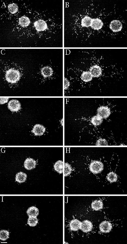 Fig. 7. Differential inhibition of capillary tube formation by factor XIIIa in γA/γA and γA/γ′ fibrin. / A 3-dimensional fibrin-based capillary tube formation assay was performed using either γA/γA fibrin (A, C, E, G, and I) or γA/γ′ fibrin (B, D, F, H, and J). Nuclei were stained with bis-benzimide after 2 days and photographed. HMEC-1 cells in γA/γA (A) and γA/γ′ (B) fibrin without factor XIIIa showed numerous capillary-like sprouts. The addition of 10 μg/mL factor XIIIa (C, D), 25 μg/mL (E, F), 50 μg/mL (G, H), and 100 μg/mL (I, J) inhibited sprouting significantly in γA/γA fibrin (C, E, G, I), but only partially in γA/γ′ fibrin (D, F, H, J). Bar, 100 μm.