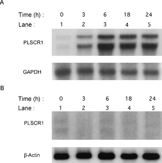Fig. 1. Induction of PLSCR1 mRNA by IFN-2a. / Northern blotting of human PLSCR1 in HT1080 cells (panel A) and in STAT-defective U3A cells (panel B) was performed using full-length cDNA for PLSCR1. Times indicate hours after addition of 1000 IU/mL IFN-α2a (see “Materials and methods”). Also shown are results obtained when same blots were probed with control cDNAs for GAPDH and β-actin.