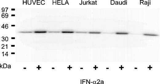 Fig. 3. Induction of PLSCR1 by IFN-2a in various human cell lines. / Western blotting for PLSCR1 was performed in cells indicated after 18 hours of treatment with 0 (−) or 1000 IU/mL (+) IFN-α2a. HUVEC denotes human umbilical vein endothelial cells. The IFN-induced increase in PLSCR1 antigen detected was 2-fold (Jurkat), 3-fold (HUVEC, HELA), and 10-fold (Daudi, Raji). Data of single experiment, representative of at least 3 similar experiments so performed on each cell line.