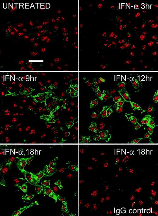 Fig. 4. Fluorescence microscopy. / HT1080 cells were incubated with 1000 IU/mL IFN-α2a for various times indicated. After fixation and permeabilization, PLSCR1 antigen (green fluorescence) was detected using mab 4D2 (see “Materials and methods”). Cell nuclei are counterstained with propidium iodide (red fluorescence). Control IgG refers to IFN-induced cells that were identically treated and stained with IgG1 murine antibody to irrelevant antigen (complement C9) substituting for mab 4D2. Data representative of 2 independent experiments so performed. White bar indicates 50 μ scale.