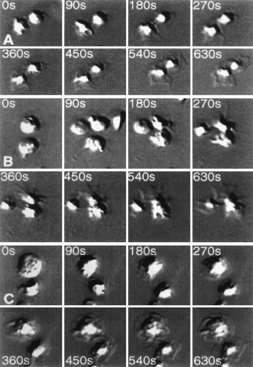 Fig. 1. Time-lapse video photographs showing spreading of platelets on monoclonal antibody mAb.F11-coated glass coverslips. / Videos were taken every 5 seconds. Selected frames at 8 different time points are displayed from time 0 (at the instance of platelet application to mAb.F11-coated coverslips to 10.5 minutes later. (A, 0-630 seconds) Demonstrates the spreading of platelets on the mAb.F11-coated surface. (B, 0-630 seconds) Spreading of platelets on the mAb.F11-coated surface in the presence of 300 μmol/L RGDS. (C, 0-630 seconds) Demonstrates the ability of platelets to spread on mAb.F11-coated surfaces in the presence of mAb.IV.3. Note: in the absence of the coated mAb.F11 IgG, the platelets did not adhere onto the surface.