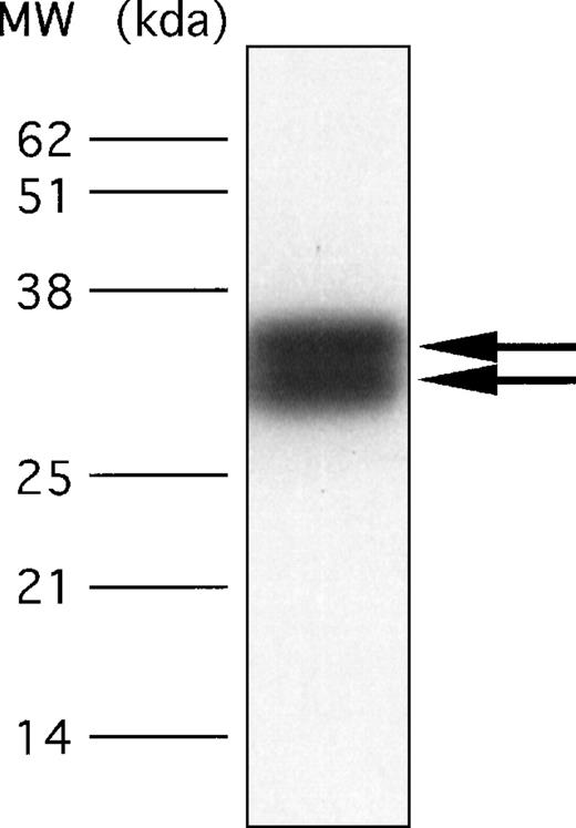 Fig. 7. Detection of the F11 receptor in human platelets by use of a polyclonal antibody directed against the 21 amino acid sequence of the N-terminus of the purified F11R. / Total platelet proteins, solubilized from approximately 2 × 107 platelets, were resolved on 15% SDS-PAGE. For immunoblotting, an anti-F11R polyclonal antibody, developed against the N-terminal sequence as detailed in “Materials and methods,” was used at a concentration of 20 μg/mL. The arrows point to the 32-kd and 35-kd glycoproteins.
