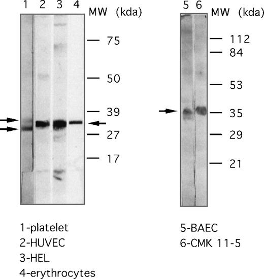 Fig. 9. Cellular distribution of the F11 receptor as determined by immunoblotting. / Expression of the F11R in platelets (lane 1), endothelial cells HUVEC (lane 2), HEL cells (lane 3), human erythrocytes (lane 4), endothelial BAEC (lane 5), and CMK 11-5 cells (lane 6). Proteins were separated on 5% to 15% polyacrylamide gel (lanes 1 to 4) or by use of 12% SDS-PAGE (lanes 5, 6). Immunoblotting was performed using mAb.F11 (4 μg/mL).