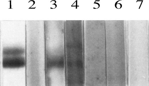 Fig. 10. Identification of F11 receptor antibodies in the circulation of patients. / The F11 receptor (5 μg applied/lane) was purified from platelet plasma membranes using the affinity chromatography procedures previously described12 and resolved by SDS-PAGE. Immunoblotting was performed using the following antibodies: lane 1, incubation with monoclonal antibody mAb.F11 (4 μg/mL); lane 2, control, incubation with only 2° antibody, rabbit antimouse immunoglobulin; lane 3, incubation with the purified immunoglobulin fraction obtained from the serum of a patient with thrombocytopenia as described in “Materials and methods” (25 μg/mL); lane 4, incubation with plasma from a patient with thrombocytopenia after kidney transplantation, as described in “Materials and methods”; lanes 5 and 6, incubation with plasma obtained from 2 healthy donors and used for immunoblotting; lane 7, control using 2° antibody, rabbit antihuman immunoglobulin.
