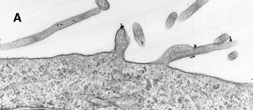 Fig. 1. Raji cell surface protrusions stained with colloidal gold conjugated to C3dg. / (A) C3dg-gold10 incubated for 7 minutes at 37°C; scale bar, 0.2 μm. (B) C3dg-gold60 incubated for 60 minutes at 37°C; scale bar, 0.6 μm.