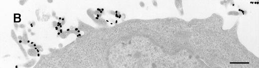 Fig. 1. Raji cell surface protrusions stained with colloidal gold conjugated to C3dg. / (A) C3dg-gold10 incubated for 7 minutes at 37°C; scale bar, 0.2 μm. (B) C3dg-gold60 incubated for 60 minutes at 37°C; scale bar, 0.6 μm.
