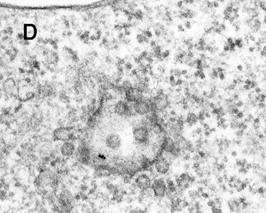 Fig. 2. Binding of C3dg-gold10 to the plasma membrane and tracing to endocytic compartments of Raji cells. / (A) C3dg-gold10 in close vicinity to a coated pit marked by an arrow (incubation for 7 minutes at 37°C); scale bar, 0.1 μm. (B, C) Within peripherally located intracellular vacuoles (7 minutes at 37°C); (B) Cryofixation; scale bar, 0.15 μm. (D) Irregularly shaped multivesicular body in the cell periphery (30 minutes at 37°C); scale bar, 0.15 μm. (E) Multivesicular body in the vicinity of the nucleus (120 minutes at 37°C); scale bar, 0.15 μm. (F) Multilaminar body (120 minutes at 37°C); scale bar, 0.15 μm. (G) Multivesicular/multilaminar body harboring aggregations of gold particles indicating flocculation caused by proteolysis of gold-coupled C3dg (note that such aggregations do not stain with anti-C3d; data not shown; incubation for 120 minutes at 37°C); scale bar, 0.15 μm.