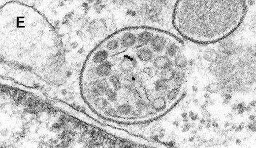 Fig. 2. Binding of C3dg-gold10 to the plasma membrane and tracing to endocytic compartments of Raji cells. / (A) C3dg-gold10 in close vicinity to a coated pit marked by an arrow (incubation for 7 minutes at 37°C); scale bar, 0.1 μm. (B, C) Within peripherally located intracellular vacuoles (7 minutes at 37°C); (B) Cryofixation; scale bar, 0.15 μm. (D) Irregularly shaped multivesicular body in the cell periphery (30 minutes at 37°C); scale bar, 0.15 μm. (E) Multivesicular body in the vicinity of the nucleus (120 minutes at 37°C); scale bar, 0.15 μm. (F) Multilaminar body (120 minutes at 37°C); scale bar, 0.15 μm. (G) Multivesicular/multilaminar body harboring aggregations of gold particles indicating flocculation caused by proteolysis of gold-coupled C3dg (note that such aggregations do not stain with anti-C3d; data not shown; incubation for 120 minutes at 37°C); scale bar, 0.15 μm.