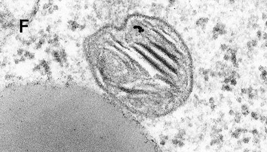 Fig. 2. Binding of C3dg-gold10 to the plasma membrane and tracing to endocytic compartments of Raji cells. / (A) C3dg-gold10 in close vicinity to a coated pit marked by an arrow (incubation for 7 minutes at 37°C); scale bar, 0.1 μm. (B, C) Within peripherally located intracellular vacuoles (7 minutes at 37°C); (B) Cryofixation; scale bar, 0.15 μm. (D) Irregularly shaped multivesicular body in the cell periphery (30 minutes at 37°C); scale bar, 0.15 μm. (E) Multivesicular body in the vicinity of the nucleus (120 minutes at 37°C); scale bar, 0.15 μm. (F) Multilaminar body (120 minutes at 37°C); scale bar, 0.15 μm. (G) Multivesicular/multilaminar body harboring aggregations of gold particles indicating flocculation caused by proteolysis of gold-coupled C3dg (note that such aggregations do not stain with anti-C3d; data not shown; incubation for 120 minutes at 37°C); scale bar, 0.15 μm.