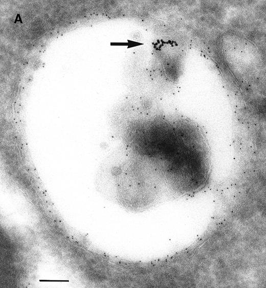Fig. 3. Immunolabeling for MHC class II or C3d on thawed Tokuyasu cryosections from Raji cells having been exposed to C3dg-gold10 for 120 minutes at 37°C. / (A, B) Class II molecules are labeled with mAb HLA-DR/CR43 (anti–β-chain) visualized by antimouse immunoglobulin coupled to 5-nm gold particles. Colocalization with internalized C3dg-gold10 (arrows) occurs in juxtanuclear endosomes; scale bar, 0.1 μm. (C) A certain amount of endocytosed C3dg-gold10 stains with rabbit antihuman C3d (visualized by antirabbit immunoglobulin coupled to 5-nm gold particles; arrowheads); scale bar, 0.2 μm. (D) C3dg-gold10 bound to cell surface protrusions readily stains with rabbit antihuman C3d (visualized as in Figure 3C); scale bar, 0.2 μm.