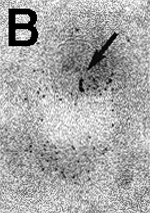 Fig. 3. Immunolabeling for MHC class II or C3d on thawed Tokuyasu cryosections from Raji cells having been exposed to C3dg-gold10 for 120 minutes at 37°C. / (A, B) Class II molecules are labeled with mAb HLA-DR/CR43 (anti–β-chain) visualized by antimouse immunoglobulin coupled to 5-nm gold particles. Colocalization with internalized C3dg-gold10 (arrows) occurs in juxtanuclear endosomes; scale bar, 0.1 μm. (C) A certain amount of endocytosed C3dg-gold10 stains with rabbit antihuman C3d (visualized by antirabbit immunoglobulin coupled to 5-nm gold particles; arrowheads); scale bar, 0.2 μm. (D) C3dg-gold10 bound to cell surface protrusions readily stains with rabbit antihuman C3d (visualized as in Figure 3C); scale bar, 0.2 μm.