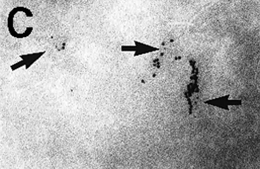 Fig. 3. Immunolabeling for MHC class II or C3d on thawed Tokuyasu cryosections from Raji cells having been exposed to C3dg-gold10 for 120 minutes at 37°C. / (A, B) Class II molecules are labeled with mAb HLA-DR/CR43 (anti–β-chain) visualized by antimouse immunoglobulin coupled to 5-nm gold particles. Colocalization with internalized C3dg-gold10 (arrows) occurs in juxtanuclear endosomes; scale bar, 0.1 μm. (C) A certain amount of endocytosed C3dg-gold10 stains with rabbit antihuman C3d (visualized by antirabbit immunoglobulin coupled to 5-nm gold particles; arrowheads); scale bar, 0.2 μm. (D) C3dg-gold10 bound to cell surface protrusions readily stains with rabbit antihuman C3d (visualized as in Figure 3C); scale bar, 0.2 μm.