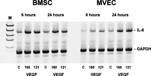 Fig. 7. Interleukin-6 (IL-6) transcripts in bone marrow stromal cells (BMSCs) and microvascular endothelial cells (MVECs) after exposure to vascular endothelial growth factor (VEGF). / Adherent cells were incubated with 50 ng/mL of VEGF165 or VEGF121 for 6 and 24 hours, respectively, and analyzed for IL-6 expression by RT-PCR. Levels of IL-6 messenger RNA (628 base pairs) were estimated by normalization against co-amplified glyceraldehyde-3-phosphate dehydrogenase. C = unstimulated controls; M = size marker.