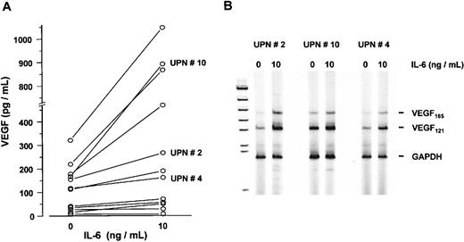 Fig. 9. Effect of interleukin-6 (IL-6) on vascular endothelial growth factor (VEGF) expression in sorted marrow myeloma cells from patients (n = 12). / (A) VEGF concentrations in supernatants of myeloma cell cultures after exposure to 0 and 10 ng/mL IL-6 for 72 hours, presented as pg/mL corrected for 106 cells. P < .005 for difference between unstimulated and stimulated myeloma cells (Wilcoxon test). (B) VEGF transcription in IL-6-stimulated myeloma cells from patients. RT-PCR analysis of VEGF transcripts after exposure to 0 or 10 ng/mL IL-6 for 72 hours. Representative examples of three patients with increased VEGF messenger RNA levels after IL-6 stimulation are shown. Corresponding patient numbers (UPN) are indicated in panels A and B.