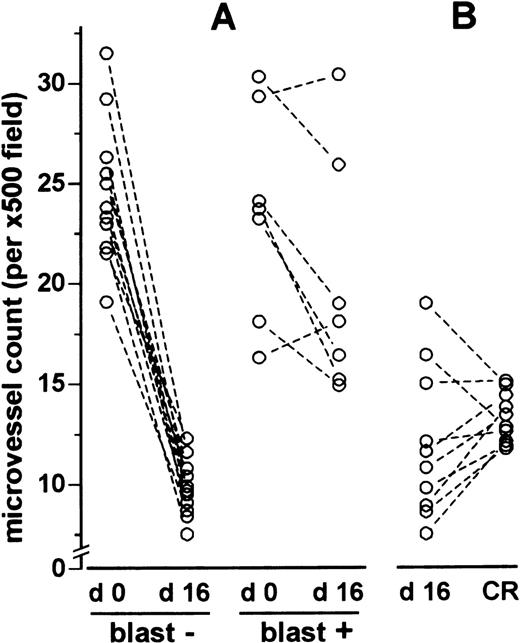 Fig. 7. Microvessel density on day 0 compared with day 16 and day 16 compared with complete remission. / (A) Microvessel density on day 16 (d 16) of induction chemotherapy compared with presentation (d 0). (B) Pair comparisons of microvessel density between day 16 (d 16) of induction chemotherapy and the time of complete remission (CR). In (A) “blast –” refers to patients without residual leukemic blast infiltration and “blast +” to patients with at least 5% residual leukemic blast infiltration. In A and B, each pair of dots linked by a line represents the values from an individual patient. The difference in microvessel counts between day 0 and day 16 in the “blast –” group was statistically significant (P < .001, Wilcoxon test), in contrast to the “blast +” group (P = .052). No differences were found by Wilcoxon test (P = .185) between day 16 and the time of complete remission.
