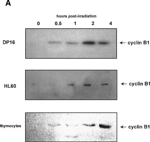 Fig. 3. Effect of γ-irradiation on cyclin B1 accumulation in hematopoietic cell lines. / (A) Protein lysates (10 μg/lane) of DP16, HL60, and primary mouse thymocytes were prepared at various time points following γ-irradiation, and the levels of cyclin B1 protein measured by Western blot. Cells were treated with 200 cGy of radiation. (B) DNA fragmentation 24 hours following treatment with γ-radiation (+ lanes). Control cells (- lanes) were mock irradiated and maintained under identical conditions. (C) Annexin staining of DP16 and HL60 24 hours following γ-irradiation (white profiles) relative to mock irradiated cells (black profiles). (D) Stimulation of cyclin B1 protein accumulation in primary thymocytes by both 200 rad of γ-radiation and 1 μg of dexamethasone. (E) Thymocyte DNA fragmentation stimulated by radiation and dexamethasone.