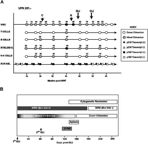 Fig. 3. Molecular follow-up of patient UPN 251 relapsing after BMT and responding to DLI. / (A) White blood cell counts, lineage-specific chimerism, and MRD (p210BCR-ABL and p190BCR-ABL) are depicted. Numbers express the percentage of host-type hemopoiesis; cytogenetic relapse (C) and hematological relapse (H) are noted in the figure. (B) Schematic representation of CML kinetic at molecular level and clinical parameters.