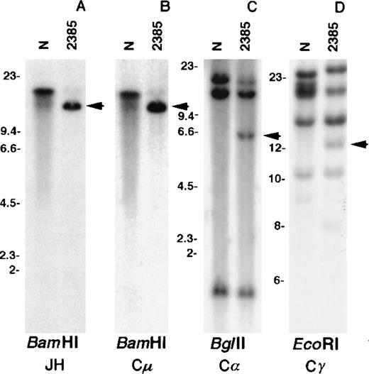Fig. 2. Southern blot analysis of tumor 2385 DNA. / DNA extracted from normal placenta (N) and tumor fluid (2385) were digested with the respective enzymes. The blots were hybridized with the IGH gene probes JH (A), Cμ (B), Cα (C), and Cγ (D). Arrows indicate rearranged bands in the tumor DNA. Size markers are given in kbp.