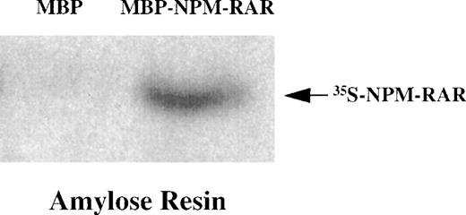Fig. 3. NPMS-RAR forms homodimers. In vitro translated 35S-NPMS-RAR was incubated with MBP or MBP-NPMS-RAR protein. Complexes were purified over amylose resin and analyzed on 8% SDS-PAGE.