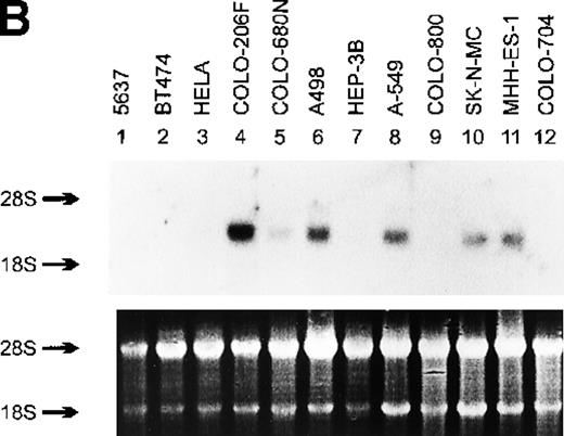 Fig. 1. Northern blot analysis of myeov gene expression in various tumor cell lines of human malignancy, a third-cycle mouse tumor (MA-T1A1) and NIH/3T3 recipient cells. / The purported or actual malignancy of the tumor cell lines are as follows: MCF-7, breast adenocarcinoma; HT-29, colon adenocarcinoma; HeLa, cervical carcinoma; THP-1, acute myeloid leukemia (M5); CCRF-CEM, T-cell acute lymphoblastic leukemia; HEL, acute myeloid leukemia (M6); Raji, Burkitt‘s lymphoma; CTV-2, acute myeloid leukemia (M5); 5637, bladder carcinoma; BT474, breast adenocarcinoma; COLO-206F, colon adenocarcinoma; COLO-680N, esophagus squamous cell carcinoma; A498, renal carcinoma; HEP-3B, hepatocellular carcinoma; A-549, lung adenocarcinoma; COLO-800, melanoma; SK-N-MC, neuroblastoma; MHH-ES-1, Ewing’s sarcoma; COLO-704, ovarian adenocarcinoma. Ten micrograms of total RNA isolated from the indicated cell lines, MA-T1A1 tumor cells (lane 9 in A) and NIH/3T3 cells (lane 10 in A), was submitted to Northern transfer. (A) Filters were hybridized simultaneously with a32P-labeled myeov cDNA insert and a murine glyceraldehyde 3-phosphate dehydrogenase (GAPDH) probe. Bothmyeov transcripts of 2.8 and 3.5 kb and the GAPDH transcript are indicated at the left side. Almost equal amounts of RNA were loaded in each lane as indicated by the GAPDH hybridization. The stronger hybridization of the 2 murine RNAs (MA-T1A1 and NIH/3T3, lanes 9 and 10) can be explained by the weaker hybridization of the murine GAPDH probe to the human homolog. (B) Filters were hybridized with the samemyeov cDNA insert; 28S and 18S ribosomal RNA were used as molecular weight markers. The lower panel shows the ethidium bromide-stained gel as a control for the amount of RNA loaded in each lane.