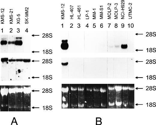 Fig. 4. Northern blot analysis of the 3 MM cell lines that show high expression of both myeov and cyclin D1 (A) and other MM cell lines (B). / Ten micrograms of total RNA isolated from the indicated cell lines was submitted to Northern transfer. The filters were independently hybridized to a 32P-labeled myeov cDNA insert (upper panel), and a cyclin D1 cDNA insert (middle panel). 28S and 18S ribosomal RNA were used as molecular weight markers. An ethidium bromide–stained gel indicates the amount of RNA loaded into each lane (lower panel).