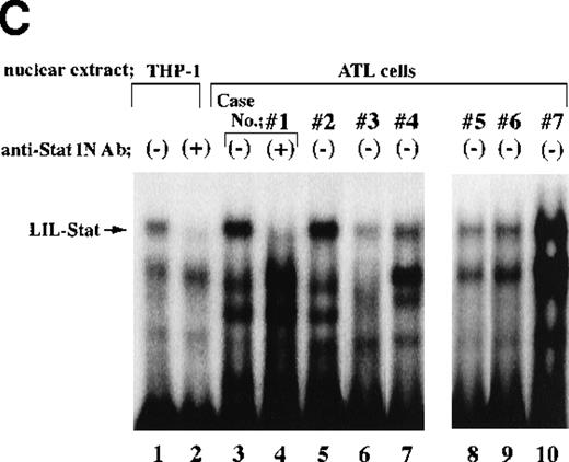 Fig. 1. Constitutive activation of LIL-Stat in leukemic cells of patients with ATL. / LILRE was used as a radiolabeled probe. Nuclear extracts were prepared from ATL cells (A, B, and lanes 3 to 10 of C) and LPS-stimulated THP-1 monocytic leukemia cells (lanes 1 and 2 of C). The double-stranded oligonucleotides used in this study were described in “Materials and methods.” Unlabeled competitor oligonucleotides were used at a 50-fold molar excess over radiolabeled LILRE probe. D shows the enhancer activity of LILRE in leukemic cells of 2 patients with ATL. Transfection of CAT reporters into ATL cells and CAT assays were carried out as described in “Materials and methods.” The CAT data were normalized to the average activity elicited by eitherfos/CAT or 3M. Error bars represent SDs from triplicate cultures.