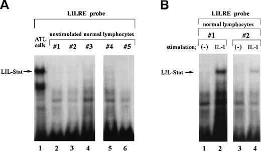 Fig. 2. LIL-Stat, which specifically recognizes the LILRE sequence, is not constitutively activated in normal lymphocytes. / A, LILRE was used as a radiolabeled probe. Nuclear extracts prepared from unstimulated lymphocytes of 5 healthy donors were used in lanes 2 to 6. As a control, an ATL cell nuclear extract was used in lane 1. B, LILRE was used as a radiolabeled probe. Nuclear extracts were obtained from untreated (lanes 1 and 3) and IL-1–treated (lanes 2 and 4) lymphocytes of 2 healthy donors. C, An ATL cell nuclear extract and radiolabeled hSIE (lanes 1 to 5) and SIE (lanes 7 to 11) probes were used. As a control study (lane 6), the ATL cell nuclear extract was incubated with a radiolabeled LILRE probe. D, LILRE (lanes 1 and 2) and hSIE (lanes 3 and 4) were used as radiolabeled probes. Lymphocytes preactivated by PHA treatment were not stimulated (lanes 1 and 3) or were stimulated with IL-2 (lanes 2 and 4). EMSAs were conducted as described in Figure 1.