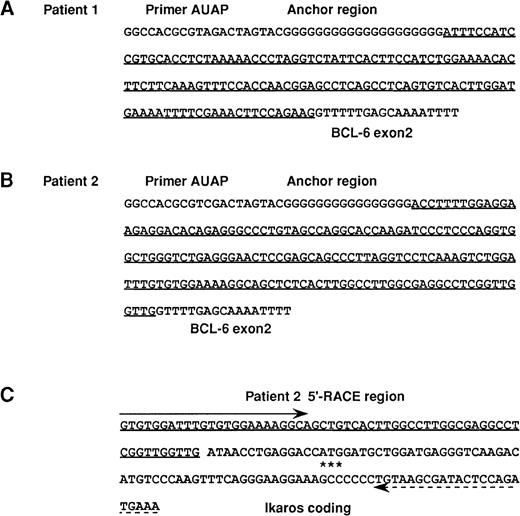 Fig. 1. 5′ RACE assay of patients 1 and 2 and RT-PCR analysis of 5′ noncoding region of Ikaros gene. / (A, B) The foreign sequences identified with the 5′-RACE method in 2 patients with DLBL with t(3;7)(q27;p12). (A) patient 1, (B) patient 2. The foreign sequences fused to BCL6sequence are underlined. GenBank accession no. AF180297. (C) Sequence of the same RT-PCR products of 4 B-cell lines obtained with a sense primer (shown by arrow) for the foreign sequence identified in patient 2 and an antisense primer (shown by dashed arrow) for the Ikaros coding region. The foreign sequence (underlined) in this patient was found to correspond to a part of the 5′ noncoding region of theIkaros gene. The translation initiation ATG codon of theIkaros gene is indicated with 3 asterisks.