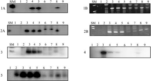 Fig. 1. Amplification of antigen receptor gene rearrangements and fusion regions of MLL-AF4/AF4-MLL rearrangements in neonatal blood spots from children with ALL using radioactive nested (TCRG, fusion sequences) or seminested (IgH, pt 3) or a nonradioactive seminested (IgH, pts 1 and 2) ASO-PCR, respectively. / Radioactive PCR products were size fractionated on denaturing polyacrylamide gels and exposed overnight. Amplified IgH products were separated on 3% agarose gels. Patients 1 and 2: (A) Amplification of the leukemia clone-specific IgH rearrangements (size: 75 base pairs (bp) and 74 bp for patients 1 and 2, respectively). (B) Amplification of the leukemia-specific MLL-AF4 (patient 1) and AF4-MLL (patient 2) fusion sequence resulting in a band of 146 bp and 143 bp, respectively. Patients 3, 4, and 5: Amplification of the leukemia clone-specific IgH rearrangement (67 bp in patient 3) and TCRG rearrangement (148 bp and 124 bp for patients 4 and 5, respectively). SM: Size marker VIII (Boehringer Mannheim, Mannheim, Germany); controls: lane 1: no DNA; lane 2: peripheral blood DNA; lanes 3-7: dilutions of leukemic DNA in DNA from peripheral blood mononuclear cells from healthy donors from 10−3 to 10−7; a sensitivity of 10−5 was achieved for all clonotypic rearrangements; lane 8: Guthrie card DNA; lane 9: Guthrie card DNA from age-matched controls.