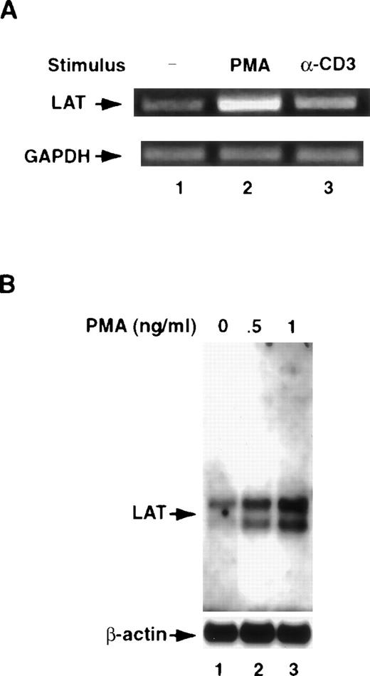 Fig. 2. T-cell activation up-regulates the level of the mRNA for LAT. / (A) Jurkat T cells were incubated as described in the legend for Figure1 for 8 hours at 37°C with RPMI-5% FCS (lane 1), RPMI-5% FCS containing 1 ng/mL of PMA (lane 2), or RPMI-5% FCS containing 1 μg/mL of anti-CD3 mAb (α-CD3; lane 3). After washing, total RNA was extracted, reverse transcribed to generate first-strand cDNA, and the resultant cDNA amplified by PCR using LAT- or GAPDH-specific primers, as described in “Materials and methods.” GAPDH gene expression was analyzed to control for mRNA integrity and loading. PCR products were visualized by ethidium bromide staining of the gel. This experiment was repeated 3 times with similar results. (B) A total of 2 × 107 Jurkat T cells were incubated for 8 hours at 37°C in RPMI-5% FCS or in RPMI-5% FCS containing the indicated concentrations of PMA. After incubation, the cells were washed in PBS, and poly A+ RNA was extracted using the Oligotex mRNA mini kit according to the manufacturer's recommendations. The resultant mRNA was subjected to 1% agarose electrophoresis and then transferred to positively charged nylon membranes. The membranes were then prehybridized for 4 hours at 50°C using the reagents provided in the Northern blotting (Max-Gly) kit. After prehybridization, the membranes were incubated for 16 hours at 50°C with a mixture of 5′-biotinylated LAT antisense oligonucleotides (upper panel). After incubation, the membranes were extensively washed, and the membrane-bound biotinylated probe was visualized as described in “Materials and methods.” To ensure equal loading, the membranes were stripped of LAT oligonucleotides by boiling for 30 minutes in 0.1% SDS and were then reprobed with a 5′-biotinylated β-actin antisense oligonucleotide. This experiment was repeated twice with similar results.
