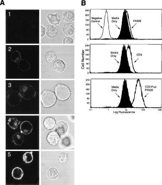 Fig. 9. LAT expressed upon CD3 ligation and FK506 treatment distributes normally in the cell. / (A) A total of 2 × 107 Jurkat T cells in RPMI-5% FCS were incubated for 16 hours at 37°C in uncoated tissue culture dishes in the absence (A2) or presence (A3) of 5 ng/mL of FK506. For CD3 stimulation, Jurkat T cells in RPMI-5% FCS were incubated for 16 hours at 37°C in anti-CD3 mAb-coated tissue culture dishes in the absence (A4) or presence (A1 and A5) of 5 ng/mL of FK506. Following incubation, cells were removed from the dishes by gentle pipetting, fixed in suspension with 2% paraformaldehyde, and permeabilized with saponin. After permeabilization, the cells were incubated for 30 minutes at room temperature with 10 μg/mL of normal rabbit Ig (A1) or anti-LAT Ab (A2-A5), washed, and then incubated for 30 minutes at room temperature with goat-antirabbit IgG conjugated to Alexa 488. After incubation, the cells were washed in TBS/Tween and then analyzed by confocal scanning laser microscopy. Both immnuofluorescence (left panel) and corresponding differential interference contrast images (right panel) are shown. Original magnification, ×600. (B) Aliquots of the labeled cells in (A) were examined for LAT expression by flow cytometry. These experiments were repeated twice with similar results.