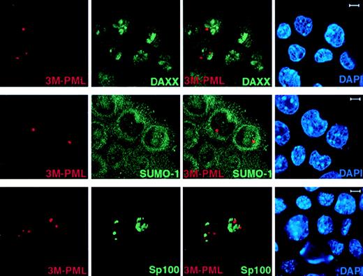 Fig. 4. 3M-PML fails to recruit Daxx, SUMO-1, and Sp100 to the NBs. / PML−/− keratinocytes were transfected with pSG5-3M-PML alone or cotransfected with pSG5-3M-PML and pEGFP-Sp100. After 24 hours, cells were harvested and cytospun onto glass slides for immunofluorescence staining. Representative confocal pictures are shown, with the immunofluorescent colors (PML, red; SUMO-1/Daxx/GFP-Sp100, green; DAPI, blue) labeled in the lower corners of each image. Bar: 5 μm.