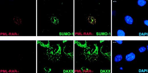 Fig. 5. In Pml−/− cells, PML-RAR accumulates in nuclear microspeckles and recruits endogenous SUMO-1 and Daxx to these aberrant sites. / PML−/− MEFs were transfected with pSG5-PML-RARα. After 24 hours, cells were harvested and cytospun onto glass slides for immunofluorescence analysis. Representative confocal pictures are shown, with the immunofluorescent colors (PML-RARα, red; SUMO-1/Daxx, green; DAPI, blue) labeled in the lower corners of each image. Bar: 5 μm.