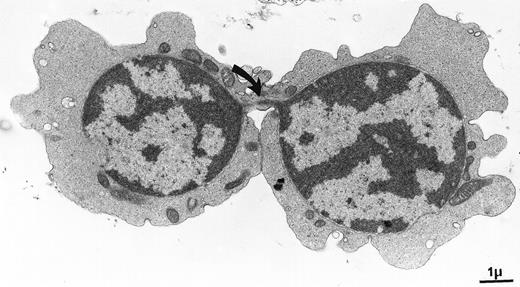 Crossing the bridge. / This micrograph shows the thin chromatin bridge linking 2 erythroblasts in a case of congenital dyserythropoietic anemia type I. We used the opportunity to section this characteristic, but rare and discrete, phenomenon. Crossing the bridge was worth the snapshot. . . . . Elisabeth M. Cramer and Josette Guichard, INSERM U.474, Hôpital de Port-Royal, Paris, France.