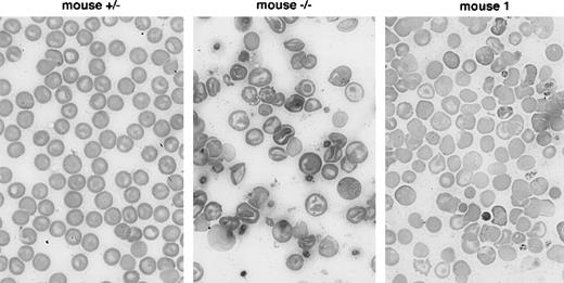 Fig. 3. Improvement of peripheral red blood cell morphology in treated β-thalassemic mice. / May-Grünwald Giemsa staining of blood smears from an untreated heterozygous mouse, from an untreated β-thalassemic mouse, and from the β-thalassemic mouse No. 1 twelve months after intramuscular injection of the rAAV-CMV-Epo vector.