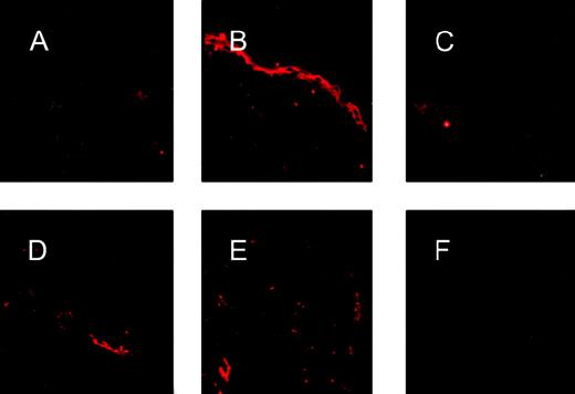 Fig. 2. FVIII antigen expression in transgenic epidermis. / Immunostaining for factor VIII expression using an antihuman factor VIII antibody (A-C) showed an intense band of staining confined to the suprabasal epidermis in transgenic skin (B), whereas nontransgenic skin (A) and transgenic skin treated only with secondary antibodies (C) show no epidermal staining for factor VIII. Immunostaining for vWF using an antihuman vWF antibody that cross-reacts with murine vWF revealed focal signals confined to the dermal vascular endothelium in both transgenic (D) and nontransgenic (E) skin. Skin from a vWF knockout mouse (F) was used as a negative control and showed no positive signal.