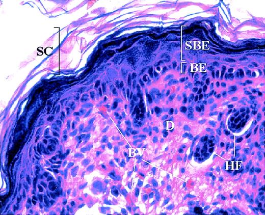 Fig. 6. Mouse skin histology. / Hemotoxylin and eosin staining of normal mouse skin showing cutaneous compartments and structures. The basal epidermis (BE) consists of a single layer of proliferating keratinocytes, which give rise to the differentiating keratinocytes of the suprabasal epidermis (SBE). The latter ultimately form the stratum corneum (SC), the outermost barrier of the skin. The dermis (D) underlies the epidermis and houses several structures, including blood vessels (BV) and hair follicles (HF).