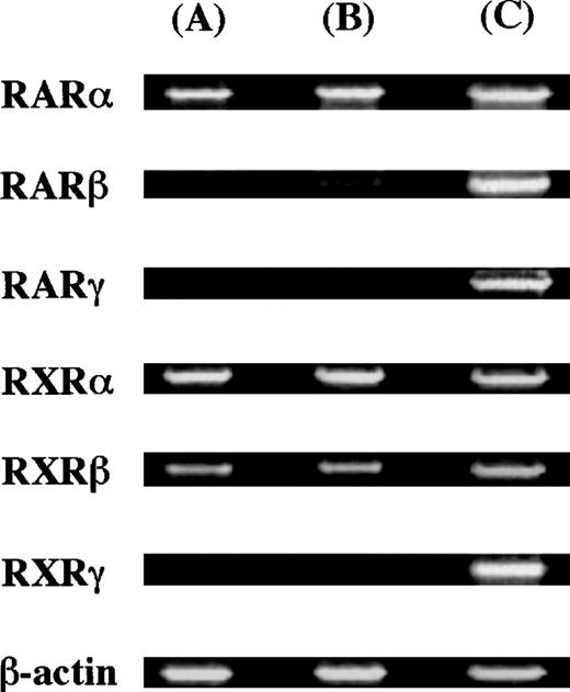 Fig. 4. Expression of nuclear retinoid receptors in cultured mast cells grown in SCF. / The cDNA of the nuclear retinoid receptors in cultured mast cells grown in SCF alone or SCF+ATRA at 10−7 mol/L was amplified by 35 cycles. As positive controls, Panc-1 cells were used for the expression of RARγ, and RPMI 8226 cells exposed to ATRA at 10−7 mol/L for 24 hours were used for the expression of the other receptors. (A) Mast cells grown in SCF at 100 ng/mL, (B) mast cells exposed to SCF at 100 ng/mL plus ATRA at 10−7 mol/L, and (C) positive controls.
